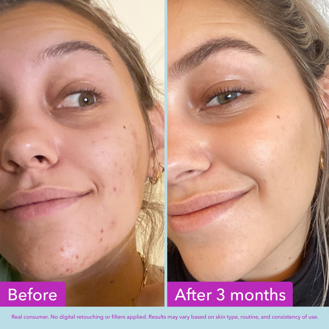 niacinamide-brightening-toner-k3 zb_p.jpg